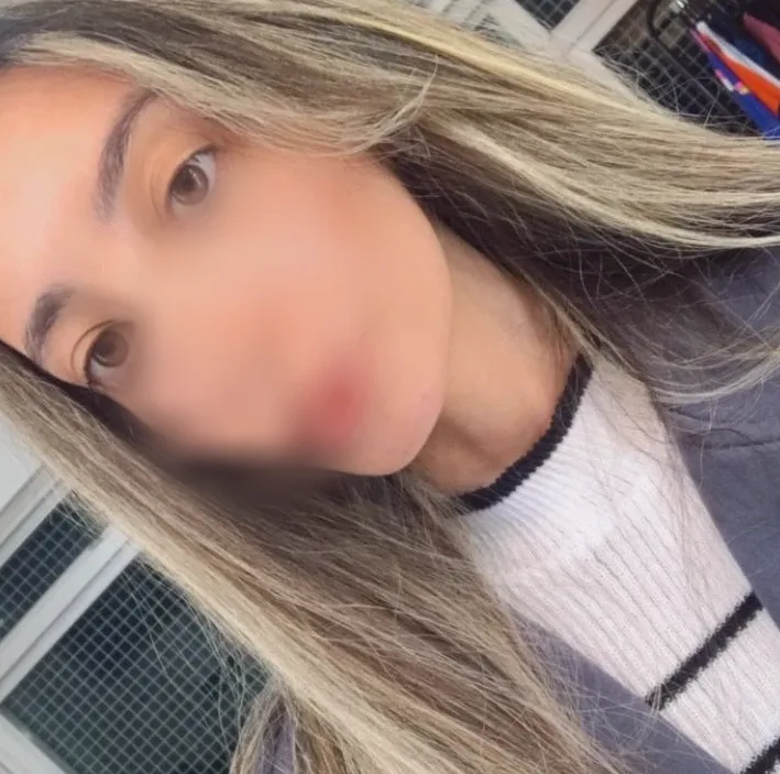 Erin, 20